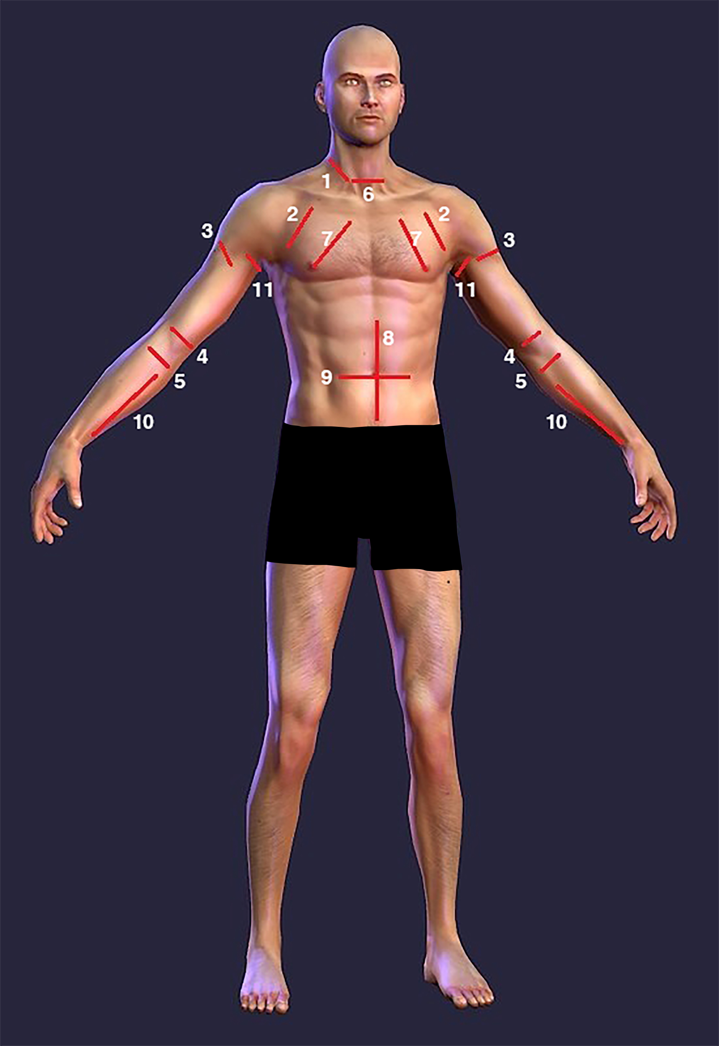 ReEvaluating Our Current Understanding Of Knife Attacks And Injuries